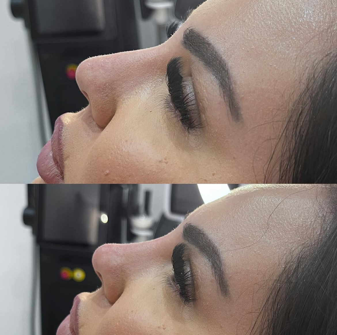 Pixie Tip Enhancement Results